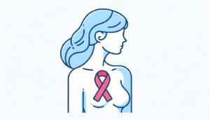 Read more about the article Fallbericht: Metastasierender Brustkrebs, 83 Frauen