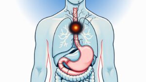 Read more about the article Case Report: Squamous Cell Esophageal Cancer, 74 male